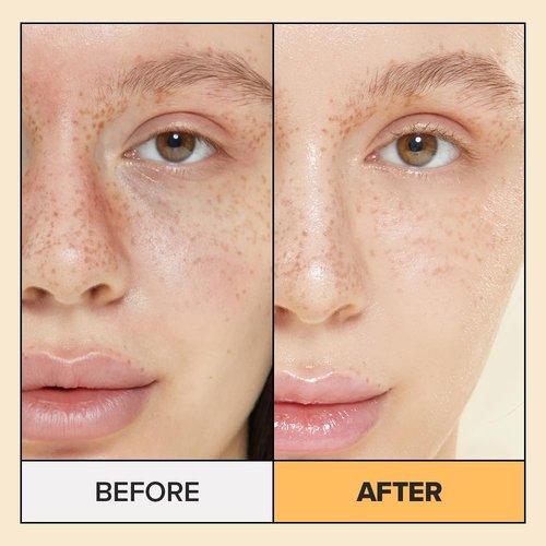I DEW CARE Calendula Sheet Face Mask - Korean Skincare for Hydrating and Calming Skin | Face Masks with Calendula Extract & Niacinamide, Moisturizing, Sheet Masks for Women, Cute Stuff, 10EA