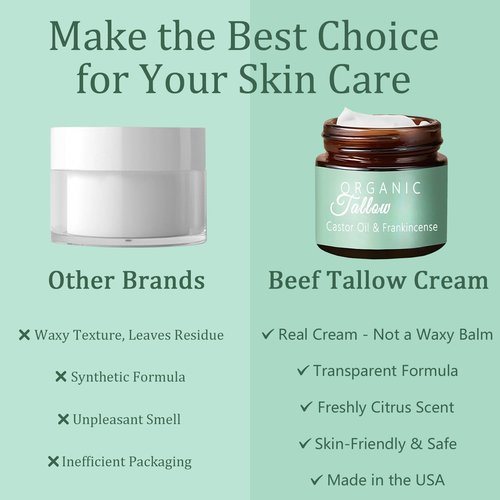 zdiwond Organic Whipped Tallow Cream Balm with Castor Oil & Frankincense Oil, 2 Pack Grass Fed Whipped Obviously Beef Tallow Cream for Natural Skincare & Moisturizing, Moisturizer for Skin/Face (2)