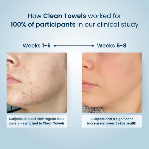 Clean Skin Club Clean Towels®, 100% USDA Biobased Face Towel, Disposable Face Towelette, Eczema Association Accepted, Makeup Remover Dry Wipes, Ultra Soft, 25 ct per pack, 4 Packs, 100 Ct Total