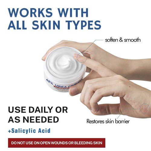 OUKEYA Urea Cream 42% plus Salicylic Acid 2% Net 5.29 Oz for Dry Cracked Feet,Heels,Knees,Elbows,Hands Repair Treatment Moisturizes and Removes Corns,Calluses,Dead Skin,and Softens Toenails Pack of 4