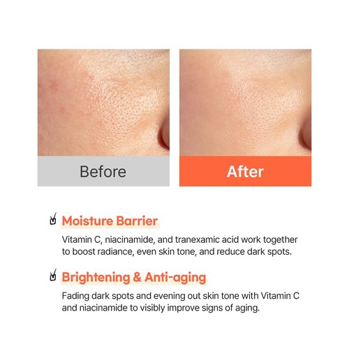 Hanskin Vitamin C Glow Capsule Face Moisturizer, Boost Radiance and Even Skin Tone, with Vitamin B and Niacinamide, Brightening Korean Skin Care, 2.7 fl oz.