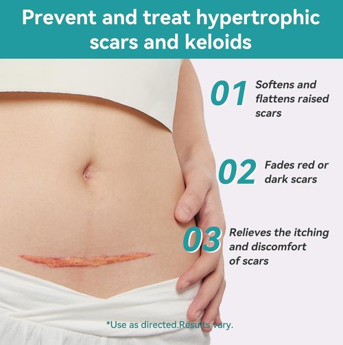 Dimora Hydrocolloid Wound Dressing & Silicone Scar Sheets