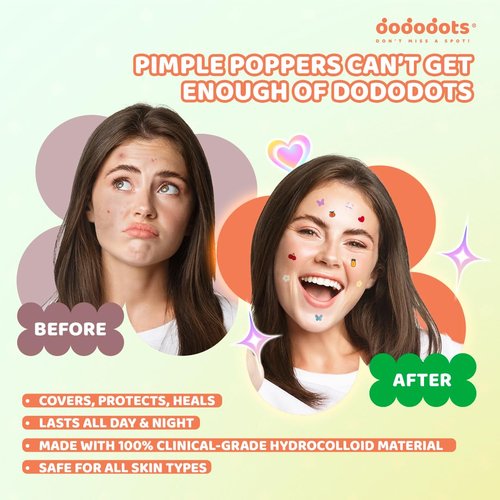 Dododots Butterfly, Cat, Flower and Heart Pimple Patches - Cute Acne Hydrocolloid Patch, Pimple Patches for Zit, Spot and Blemish Treatment, 80 Acne Patches, 4 Set for Quick Acne Relief