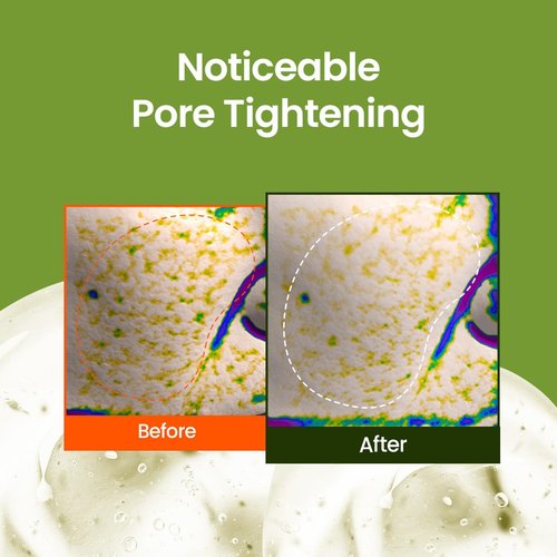 beplain Mung Bean Pore Tight -Up Serum | Niacinamide serum | Pore Minimizing | Redness Relief | Hydration | Korean Skincare, For All Skin Types (1.69 fl.oz/50ml)