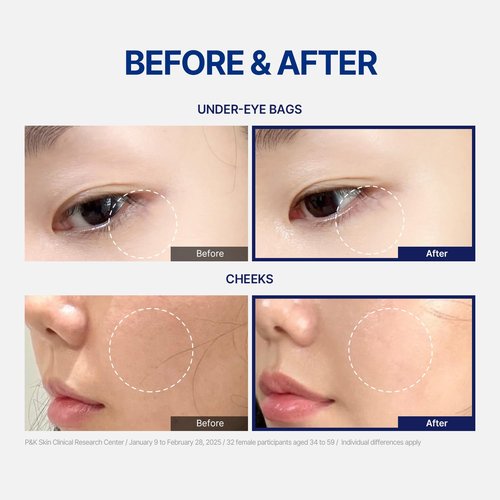 StayUth Wrinkle Spot Treatment Serum - Korean Skincare Anti-Wrinkle Brightening Serum with Peptides and Fermented Extracts for Glass Skin, Radiance & Hydration Support (15ml / 0.5 fl. oz)