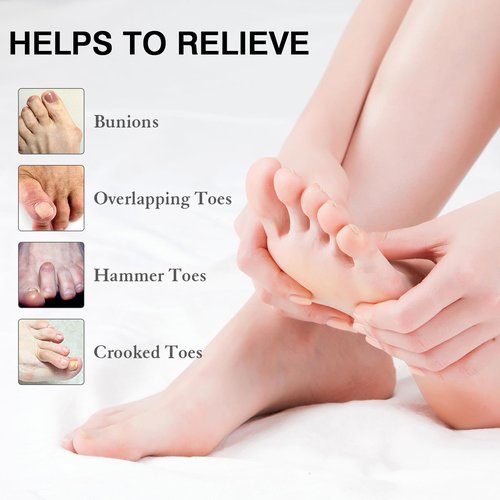 HLOES 8PCS Toe Spacers for Women and Men, Toe Separators for Pedicure, Bunion Corrector, Hammer Toe Straightener, Plantar Fasciitis, Toe Spreaders for Foot Pain Relief and Foot Health.