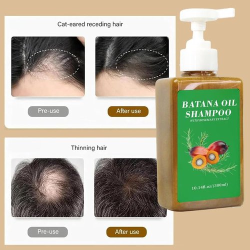 300ml Batana Oil Shampoo,Batana Shampoo,Batana Oil For Hair Growth Shampoo,Batana Oil For Hair Growth,Batana Oil Shampoo With Rosemary Extract (2PC)