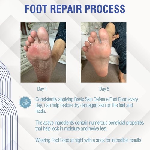 Basix Skin Defence Foot Food Repair Restore Tired Dry Feet Cracked Heels 5% Urea and Peppermint Oil Soothes Invigorates and Stimulates Tired Feet