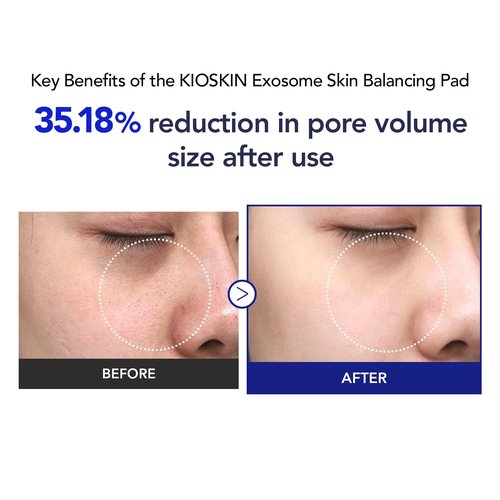 35% Smaller Pores & 32% Reduced Pore Area – Improves Skin Texture by 8% – Soothes, Hydrates & Brightens with CICA Exosomes, AHA/BHA/PHA & Fruit Enzymes – Korean Skincare Favorite Toner Pad Kioskin