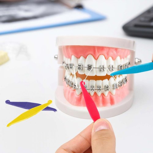 SenseYo 200 Pcs Colorful Dental Elastic Braces Rubber Band Tool for Orthodontic Braces (Pack of 2)