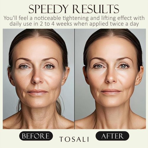 TOSALI Anti Aging Skincare Set – Daily Peeling Mask (6.8 oz), Deep Wrinkle Serum (1.7 fl oz) & Face Cream (1.7 oz) – Hydrating, Brightening, Wrinkle Reduction & Skin Firming for All Skin Types