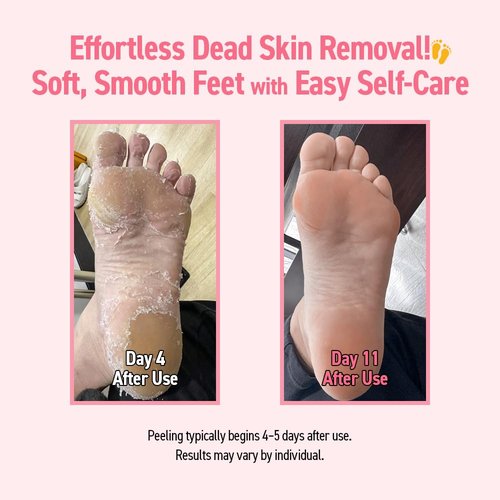 MADFORCOS Silky Smooth Foot Peeling Mask – Exfoliating Booties for Soft Feet, Callus & Dead Skin Remover, Easy At-Home Pedicure (2 Pairs / 4 Pairs) (4 Pairs (Pack of 1))