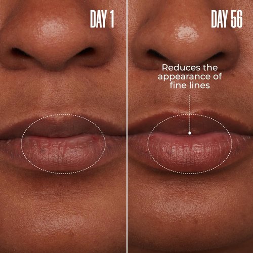 MAËLYS Cosmetics TOO-POUTY Clinically Proven Lip Plumping Mask - Helps Reduce The Appearance Of Fine Lines - Contains Adeplump to Plump The Look Of Lips