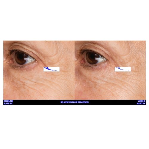 Serious Skincare - Ultra-Mare Pure Marine Infusion Revitalizing Eye Cream - Peptides - Skin Renewing - Encourages Collagen Production - Helps Reduce Wrinkle Depth - 0.5 oz