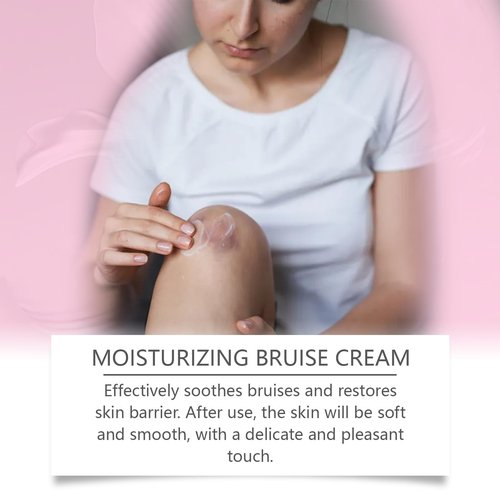 Bruise Cream – Moisturizing & Firming Formula for Arms, Legs & Hands – Restores Fragile Skin with Anti-Wrinkle Benefits – 4.23 oz