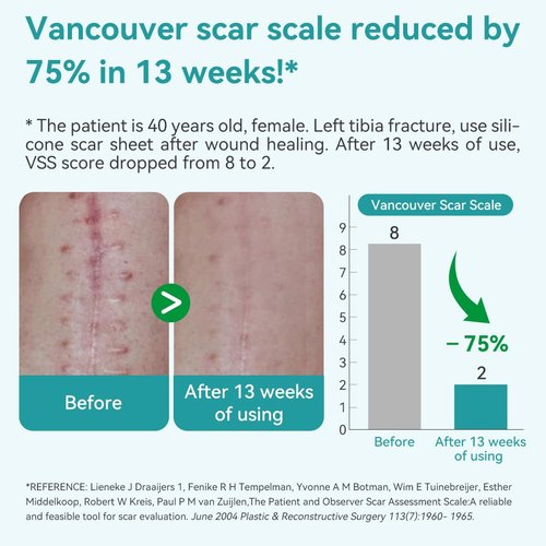 Dimora Hydrocolloid Wound Dressing & Silicone Scar Sheets