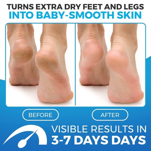 Imperial Feet Foot Balm Soft - Cream for Dry Skin - for Dry feet - Soft and Smooth Feet - Honey - 150ML