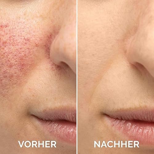 Vitamin C Serum For Face, Anti Aging Face Serum with Vitamin C, Hyaluronic Acid, Vitamin E ? Brightening Formula ? Improve Appearance of Dark Spots, Tone, Fine Lines & Wrinkles (2Pcs)