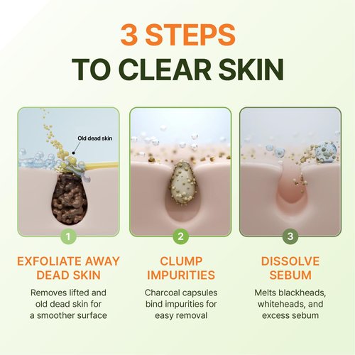 Centellian 24 Madeca Matcha Toning Peeling Gel (Peeling Gel, 5.07fl oz) – Gentle Exfoliator for Clear, Smooth & Balanced Skin, Korean Skin Care. Matcha-TECA Complex, Charcoal Capsules.