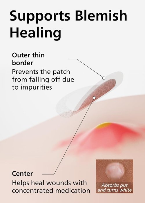 DWEasyDerm EasyDerm Beauty Patch(126 Counts) - 100% Hydrocolloid Pimple Patch for Zit Spot Care, K-beauty, Daewoong Pharmaceutical, Korean Acne Patches