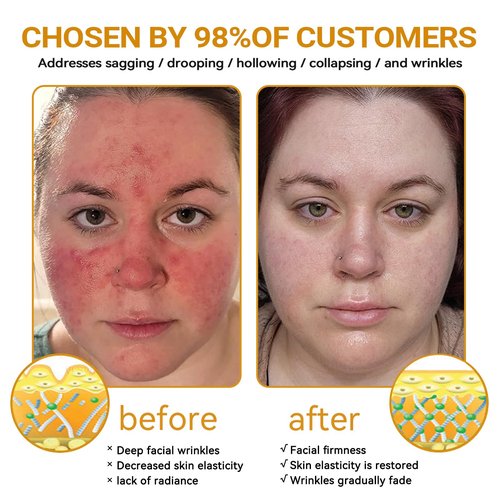 APKAPK Bee Venom Comprehensive Cream, Professional Bee Venom Skin Treatment Cream, bee Venom All-in-One Cream-50G, Anti-Aging, Hydrating, Natural Ingredients for All Skin Types (2 Bottle)