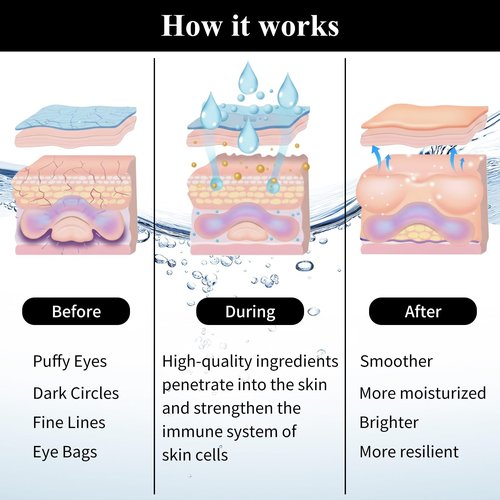 SPRINGSKY Under Eye Patches,Lace Eye Mask for Puffy Eyes and Dark Circles,Collagen Skin Care Products,Hydrating,Smoothing,Anti-Aging Eye Patch for Under Eye Bags（24 Pairs）