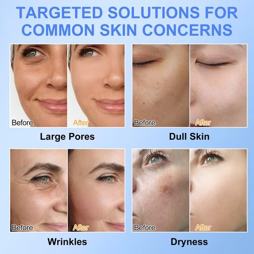 Akeeronn Collagen Face Mask, Bio-Collagen Deep Hydrating Overnight Mask with Hyaluronic Acid, Anti Wrinkle Lifting Mask for All Skin Types, Anti Aging Facial Mask, Firming&Elasticity(2pack, 12pcs)