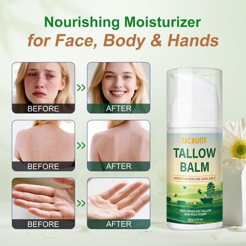 Tacruitf Beef Tallow Balm, 100% Grass Fed Beef Tallow, Whipped Moisturizer for Sensitive Skin, Handmade All-Natural Moisturizer for Soft And Smooth Skin (7 Oz, Unscented)