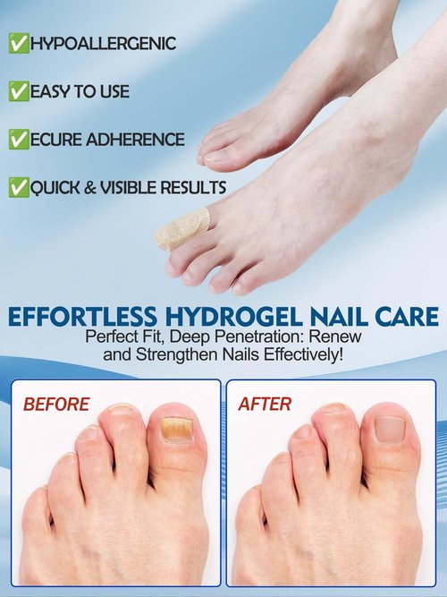 Nail Patches 48 PCS Toenail Treatment Extra Strength 8-Hour Overnight Nail Fast Acting Repair Effortless Hydrogel Nail Care and Repair for Damaged Nails Overnight Renewal for Men and Women