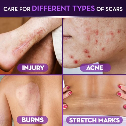 Cicatricure Advanced Scar Gel for Face & Body - Proven Results in 2 Weeks, Scar Treatment for Surgical Scars, Stretch Marks, Scars of Burns and Injuries, Acne Scar Treatment, 2 oz (56g)