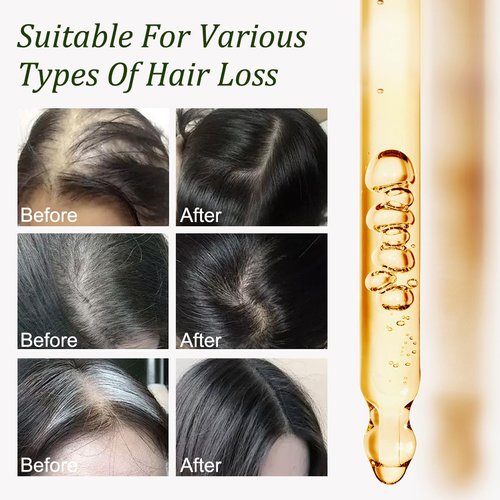 Batana Shampoo & Batana Oil & Hair Mask-Combo Set