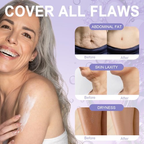 Anroha Moon Dream Overnight Toning Whip - Get Body Firming Cream for Women - Age Defying Lift and Frim Cream Helps Target the Appearance of Loose Skin On the Body 6.8 Fl oz
