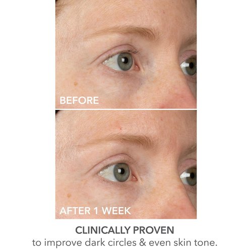 Dr Dennis Gross DermInfusions Lift + Repair Eye Mask | Visibily Lift + Firm, Fills the Appearance of Fine Lines, Deepy Hydrates + Repairs, Visibly Depuffs the Undereye Area | 4 Treatments