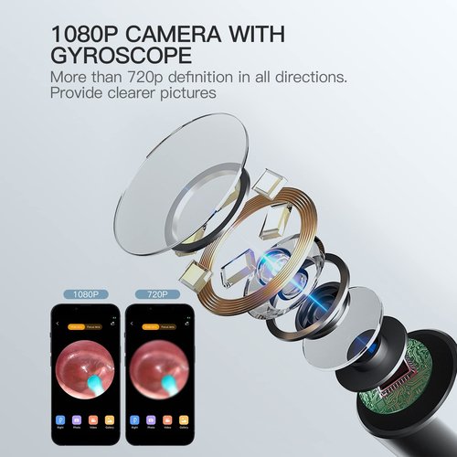 Ear Wax Removal Tool Camera, Ear Cleaner with Camera Earwax Removal kit with Camera, Ear Camera 1080P with 6 LED Lights, Compatible with iOS&Android