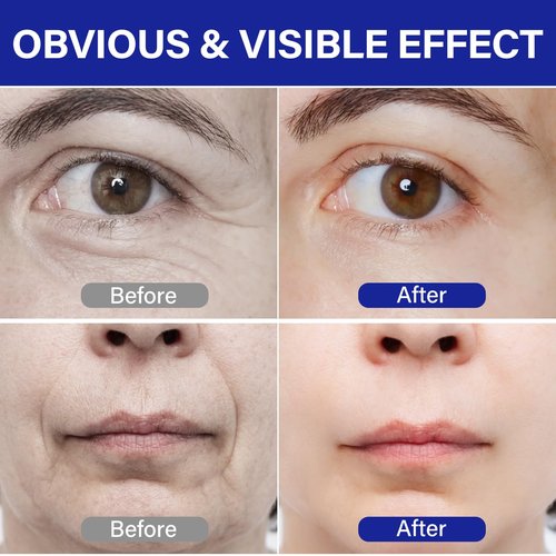 PDRN Serum丨Lifts and firms, Reduces Wrinkles, Deeply Moisturizes丨Peptides, PDRN丨Anti-aging, Improves Dullness