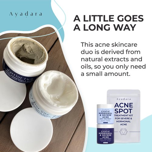 Ayadara Day & Night Cystic Acne Spot Care for Skin, Hormonal Acne Support for Daytime & Overnight, Cystic Acne Skin Balancing Formula for Face, Acne Cream with Tea Tree & Bentonite Clay, 90 Day Supply