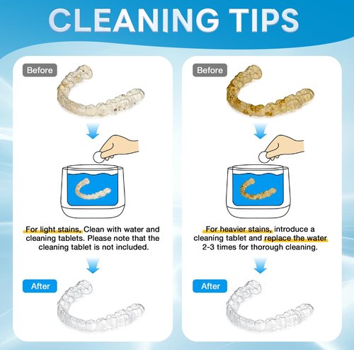 Exluvon Ultrasonic Retainer Cleaner 45kHz, 250ML Portable Ultrasonic Cleaner, Professional Retainer Cleaner Machine for Dentures, Mouth Guard, Aligner and Jewelry
