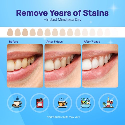 Whitebite Pro Upgraded Teeth Whitening Strips 28 Strips (14 Treatments) | Enamel-Safe | Deep Stains Removal | Non-Slip Design | Whitening Without Any Harm | Mint