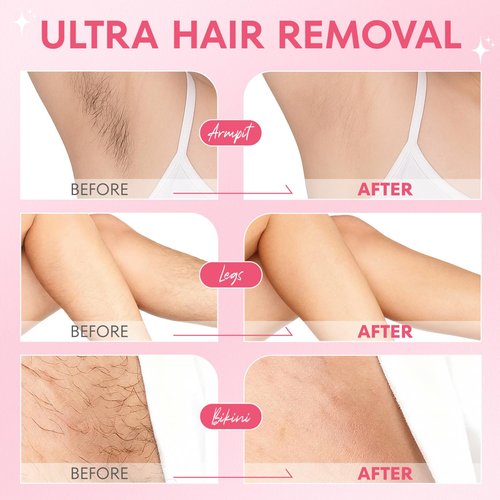 VG VOGCREST Bikini Trimmer for Women: 2-in-1 Painless Body Shaver for Underarm Leg Arm with Length Combs - Portable Travel Friendly Pubic Grooming Kit - Rechargeable Electric Razor with Charging Dock