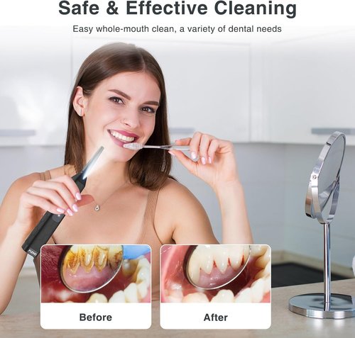 Electronic Tonsil Stone Remover Vacuum, 5X Magnifying Mirror, 3 Modes, LED Light Mouthwash, Bad Breath Water Flosser