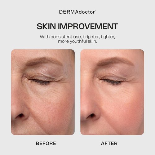 DERMAdoctor Glycolic Acid Exfoliating Face Wash - Anti-Aging, Antioxidant Enhanced Glycolic Acid Toner Facial Exfoliator to Address Fine Lines, Wrinkles, Dullness, Uneven Skin Tone, and Enlarged Pores