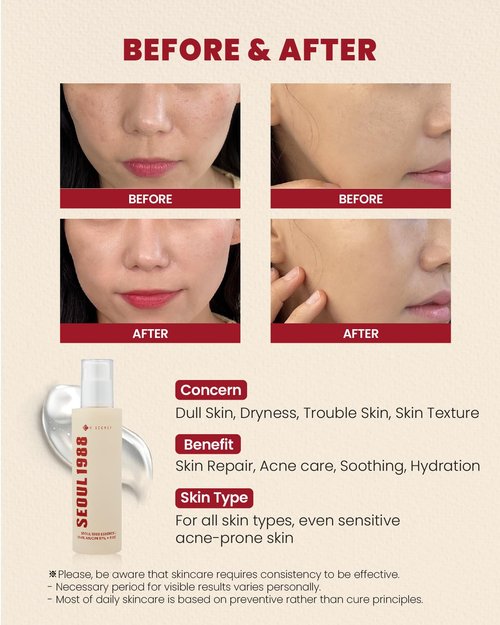 K-SECRET SEOUL 1988 Snail Mucin 97% Essence – Concentrated Yet Lightweight Formula Infused with 97% Snail Mucin | Soothing & Fast-Absorption Facial Serum | Korean Skincare, 100ml / 3.38 fl oz