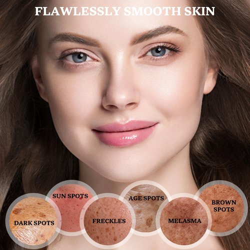 Dark Spot Remover for Face and Body: Dark Spot Corrector Cream, Melasma, Freckle, Sun Spot, Age Spot Remover with Niacinamide and Vitamin C, Advanced Formula for Women and Men (1.7 Fl Oz)