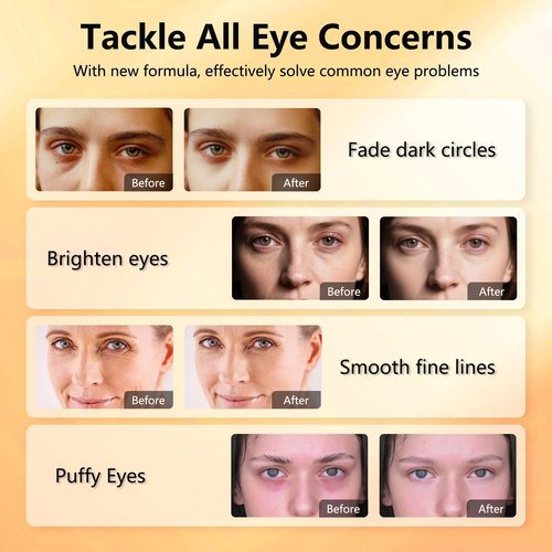 Aeryea Under Eye Patches with Vitamin C & Caffeine 30 Pairs for Dark Circles, Fine Lines and Puffiness, with Niacinamide Hydra-Gel Collagen, Skin Care for Men & Women - 2 PACK