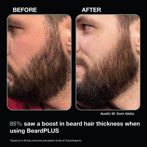 ZEUS BeardPlus Beard Shampoo & Conditioner Set for Men, Beard Growth Treatment for Hydration, Softness & Thickness with Biotin & Caffeine (Made in USA) Combo Set