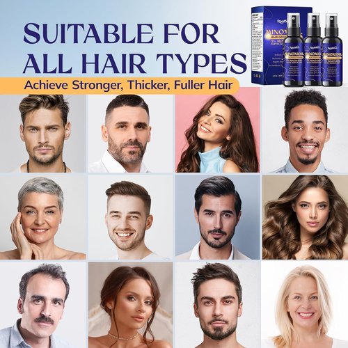 5% Minoxidil Kit for Men and Women – 3-Pack Beard Growth Kit & Hair Regrowth Spray – Targets Thinning Hairlines, Crowns & Patchy Beards – 180 mL