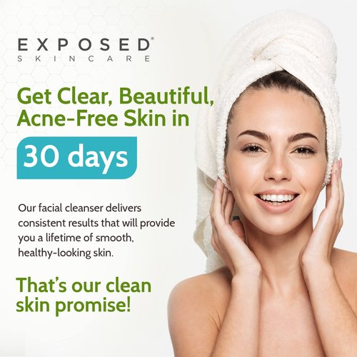 Exposed Skin Care, Acne Facial Cleanser with 0.5% Salicylic Acid for Sensitive and Acne-Prone Skin – Gentle Daily Face Wash for Breakout, Blackhead and Excess Oil – Natural, Non-toxic and Cruelty Free