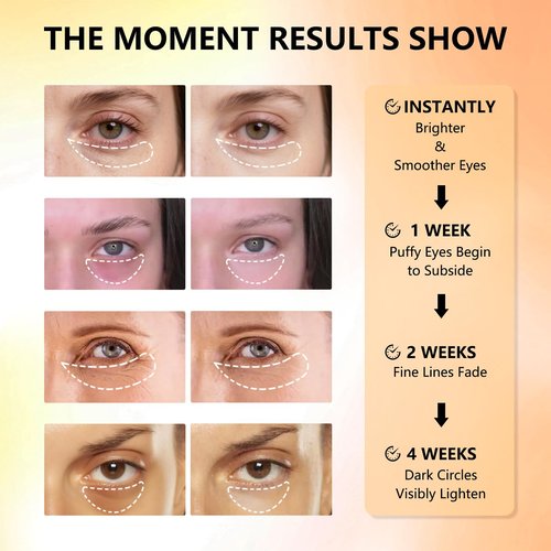 Aeryea Under Eye Patches with Vitamin C & Caffeine 30 Pairs for Dark Circles, Fine Lines and Puffiness, with Niacinamide Hydra-Gel Collagen, Skin Care for Men & Women - 2 PACK
