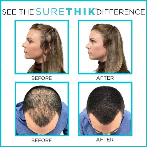 SURETHIK 15g Hair Thickening Fiber (Dark Brown) + Patented Application Tools