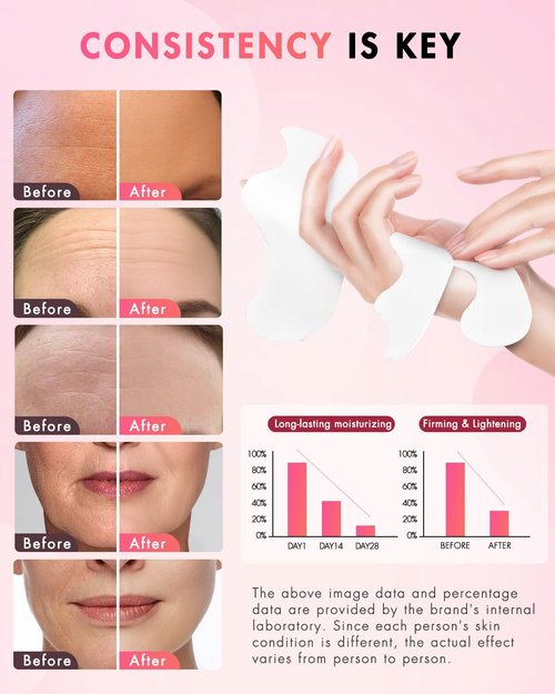 UKVOA Forehead Wrinkle Patches & Smile Line Patches, Overnight Facial Wrinkle Treatment with Hyaluronic Acid, Aloe, Collagen & Vitamin E to Lift Smile Lines for Women 36pcs with Face Retinol Cream